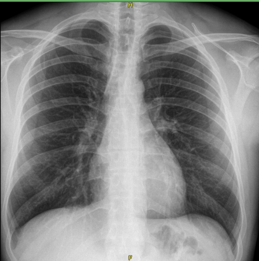 Резултат с изображение за „рентгенов апарат за клинични цели.“"